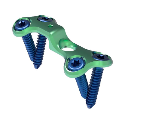 VOLGA Locking Lapidus Plates 3.5mm by Madison Ortho