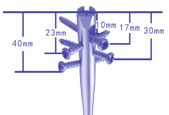 ELBRUS Enhanced Tibia Nailing System