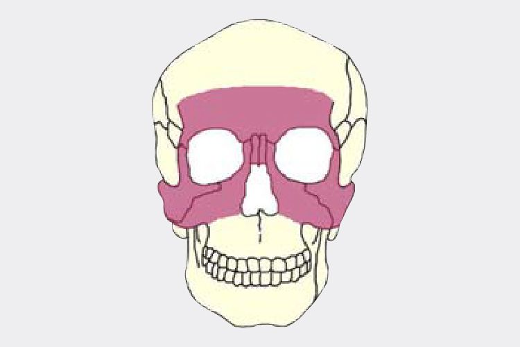 Craniomaxillofacial CMF Micro and Mini Plating System
