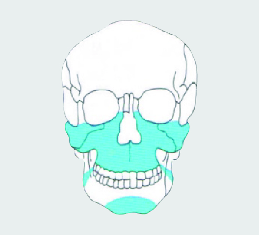 RHEIN 2.0 Maxillofacial Titanium Plating System