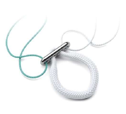 Suspensory Button for ACL and PCL knee reconstruction
