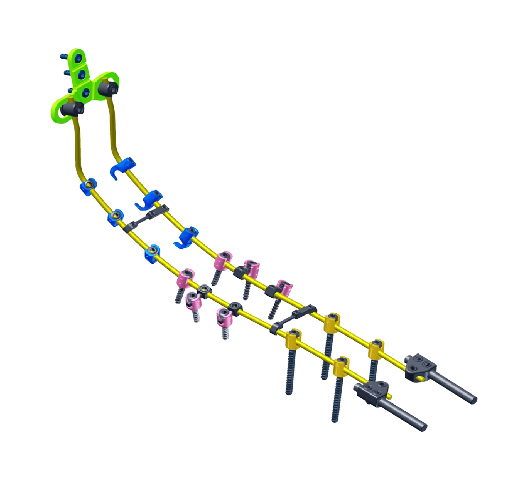 PLUTO Occipito-Cervical Fusion System