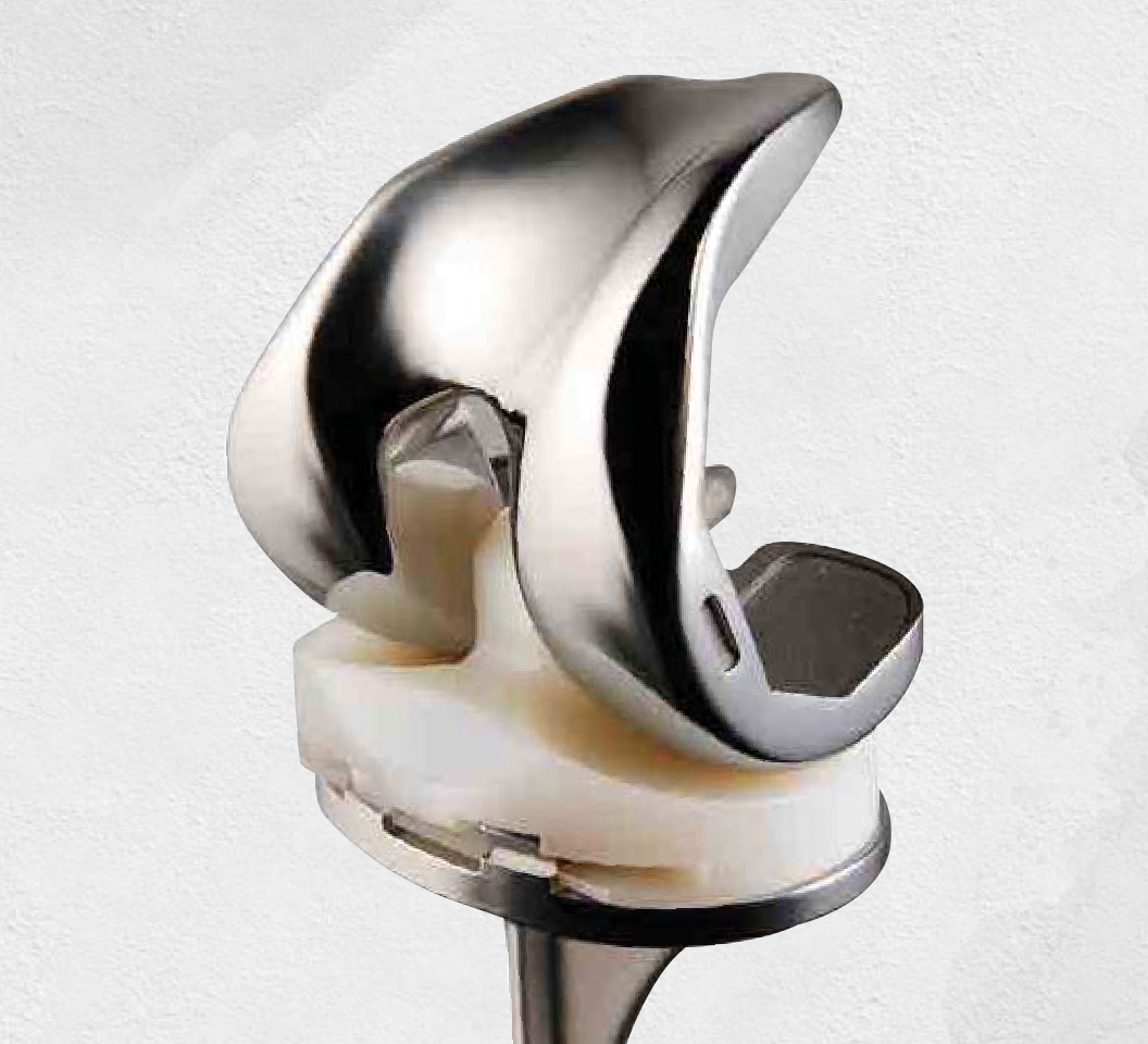 Total Knee Replacement Prosthesis System
